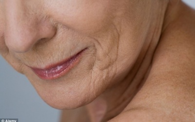 Giảm nếp nhăn ở cằm bằng cách nào?