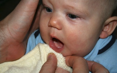 Con bị nấm miệng, làm cách nào chữa khỏi?
