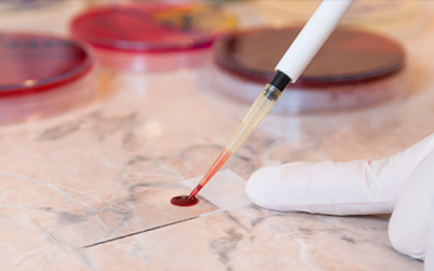 Hy vọng mới cho người bệnh hồng cầu hình liềm