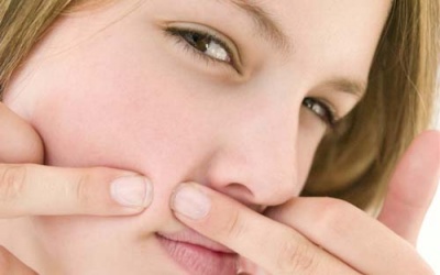 Nặn mụn ở đâu cũng được nhưng vị trí này thì tuyệt đối không-được-đụng-đến