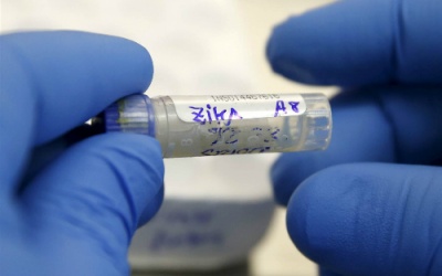 30 bệnh viện xét nghiệm virus Zika miễn phí