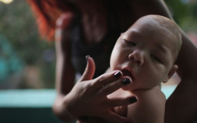 Bệnh đầu nhỏ do Zika chỉ phát hiện vào cuối thai kỳ