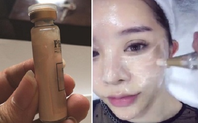 Cấy phấn cho da – Một kiểu làm đẹp mạo hiểm
