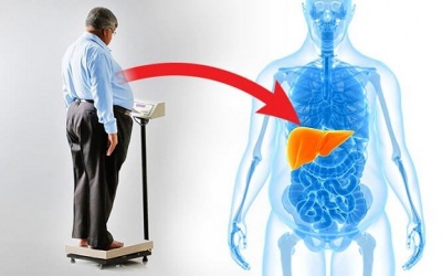 Người béo phì mắc đái tháo đường type 2 dễ bị ung thư gan