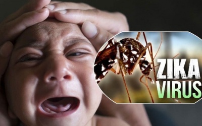 Dị tật đầu nhỏ ảnh hưởng gì đến sự phát triển của trẻ?