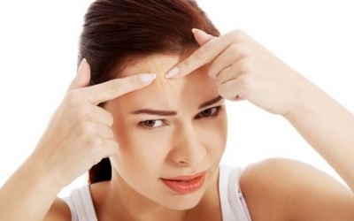 Điều trị mụn ở trán bằng nguyên liệu tự nhiên