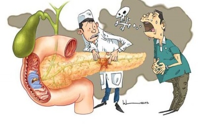 6 triệu chứng thường gặp của bệnh ung thư tuyến tụy