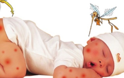 Vết muỗi đốt sưng to có nguy hiểm?