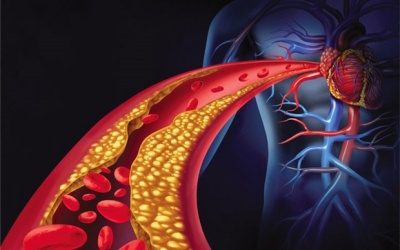 Hãy xóa nỗi ám ảnh về cholesterol
