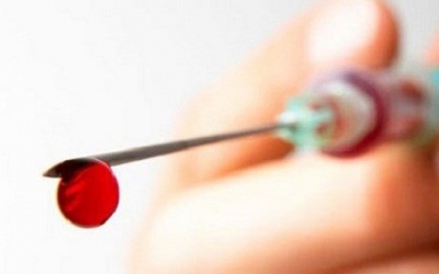 Lưu ý khi hiến máu và truyền máu để tránh HIV