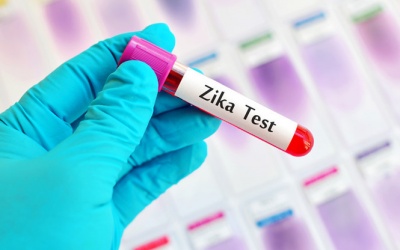79 người ở TP.HCM nhiễm virus Zika