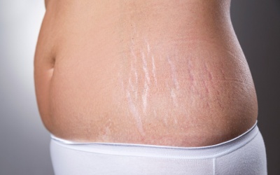 Sinh thường sau bao lâu thì có thể dùng kem bôi và viên uống Babolica?