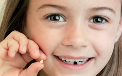 Răng vĩnh viễn mọc nhưng răng sữa vẫn chưa rụng phải làm sao?