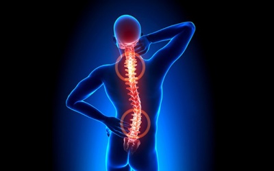 Viêm cột sống dính khớp ảnh hưởng thế nào tới sức khỏe?