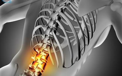 Điều trị bệnh gai cột sống như thế nào mới hiệu quả