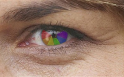 Bị bệnh mù màu chữa như thế nào?