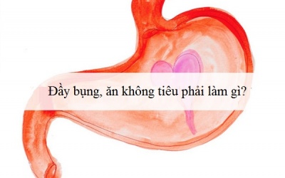 Đầy bụng, ăn không tiêu phải làm gì để nhanh hết?