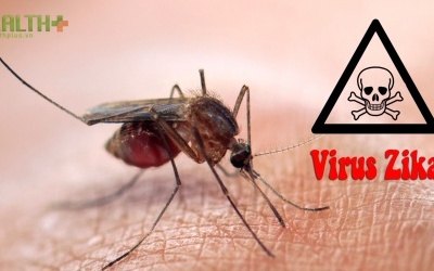 Bệnh do virus Zika sẽ lưu hành như bệnh sốt xuất huyết?