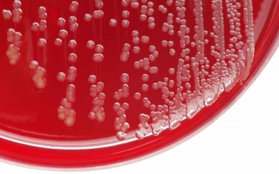 4 dấu hiệu cảnh báo bạn nhiễm tụ cầu khuẩn