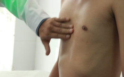 Lõm ngực bẩm sinh điều trị thế nào?