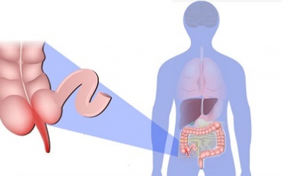 Ruột thừa hóa ra không vô dụng như chúng ta vẫn nghĩ
