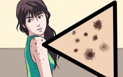 Có những loài vi khuẩn nào đang trú ẩn trong da của bạn?