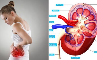 Nguy cơ mắc bệnh thận từ các vitamin và khoáng chất