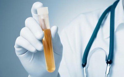 Nước tiểu tố cáo bạn đã ăn gì hôm qua