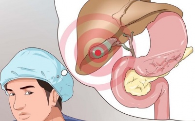 Infographic: 1 số dạng bệnh túi mật thường gặp