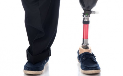 Các biến chứng đái tháo đường có thể khiến bạn phải cắt cụt chân