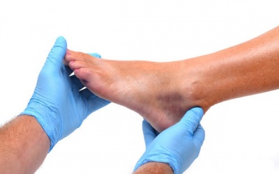 Cắt cụt chân do đái tháo đường: Nguy cơ và cách phòng tránh
