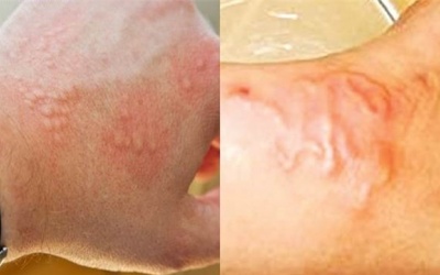 Thấy ai trong gia đình có dấu hiệu này, cần phải xổ giun ngay lập tức