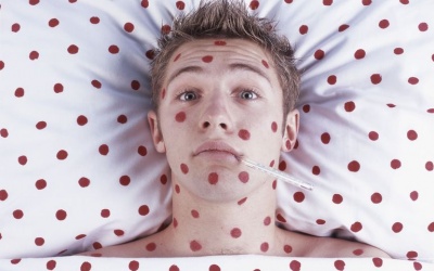 6 biến chứng nguy hiểm thường gặp khi bị thủy đậu