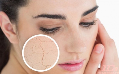 6 vấn đề ở da cảnh báo bệnh nguy hiểm