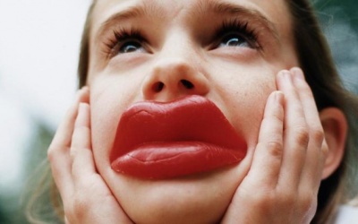 6 nguyên nhân khiến môi bạn sưng phồng