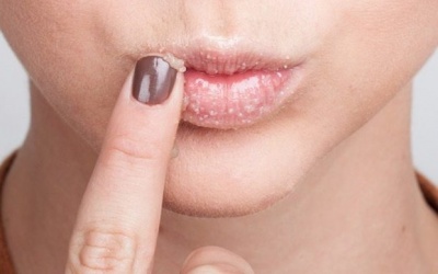 4 biện pháp giúp đôi môi trông hồng hào, căng mọng hơn