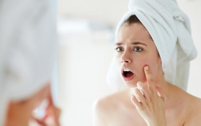  Video: 5 cách giúp bạn đối phó với mụn trứng cá