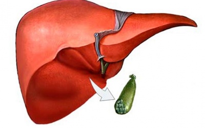 Bạn cần biết gì về chế độ ăn sau khi cắt bỏ túi mật?