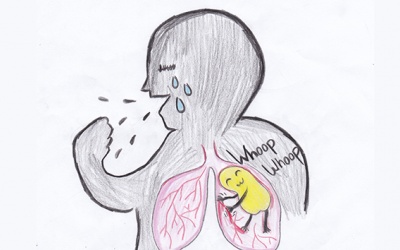 Có nên tự điều trị ho gà tại nhà bằng thuốc kháng sinh?