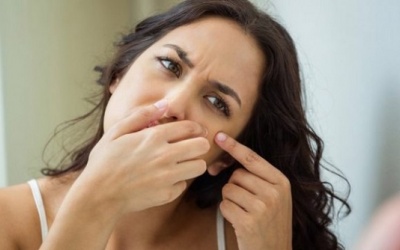 Làm sao để tránh hình thành sẹo sau khi nặn mụn trứng cá?