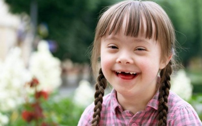 Chữa được bệnh Down?