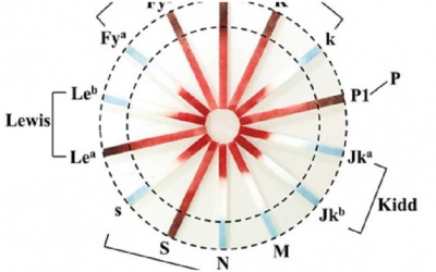 Que thử xác định nhóm máu chưa mất đến một phút