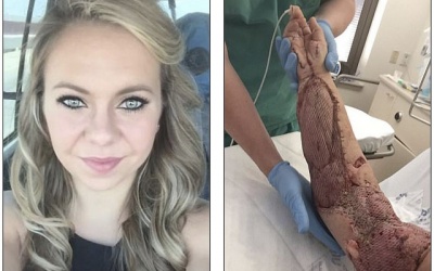 Kỳ diệu cánh tay nát bươm được hồi sinh