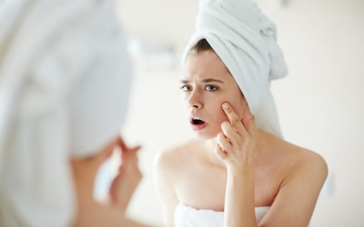 9 cách đơn giản giúp điều trị mụn trứng cá ngay tại nhà