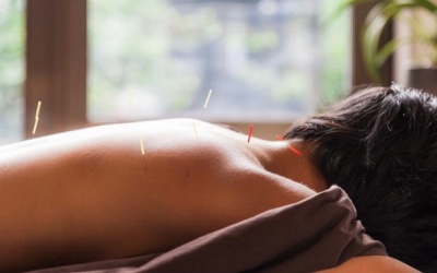 Châm cứu giúp làm chậm quá trình tiến triển của bệnh Parkinson