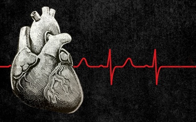 Điều gì có thể kích hoạt một cơn rung nhĩ?