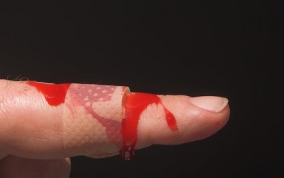 Thảo dược tốt cho người bị hemophilia