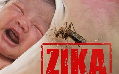 Động kinh - Một nguy cơ tiềm tàng khác của trẻ bị virus Zika