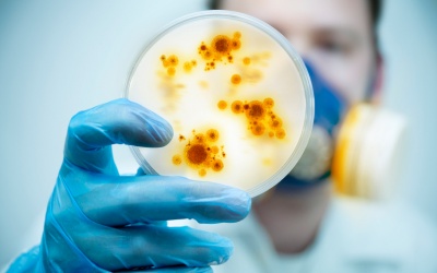 Vi khuẩn gây viêm nướu cũng gây ra viêm khớp