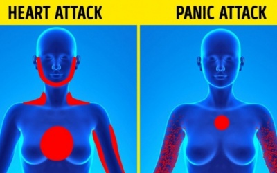 Cách đơn giản phân biệt cơn đau tim và cơn hoảng loạn